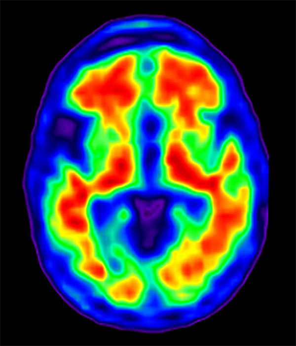 PET scan image - a colorful brain
