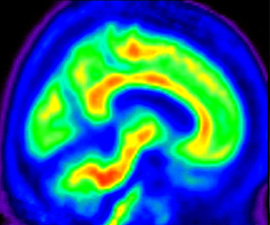 Brain scans of healthy adults
